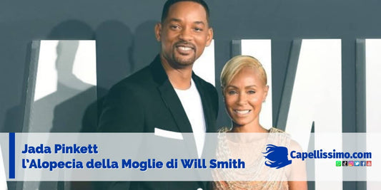 Jada Pinkett moglie will smith alopecia