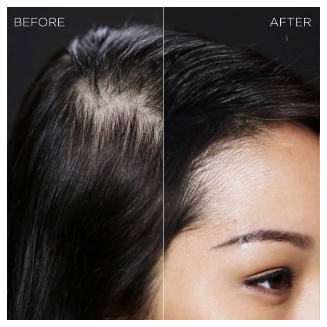 Prima e dopo Toppik capelli donna