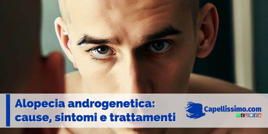 alopecia androgenetica cause sintomi e trattamenti