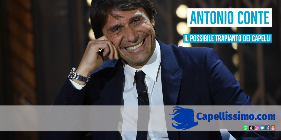 antonio conte calvizie