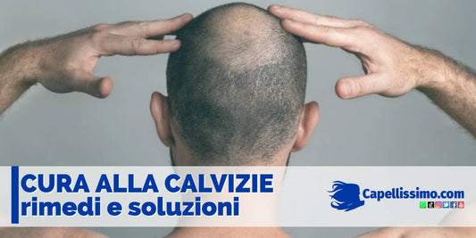 cura alla calvizie rimedi e soluzioni